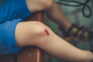 The Process of Filing a Personal Injury Lawsuit